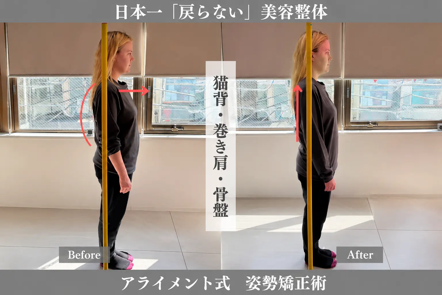 姿勢矯正のBefore After — 側面全身・姿勢｜Alignment TOKYO