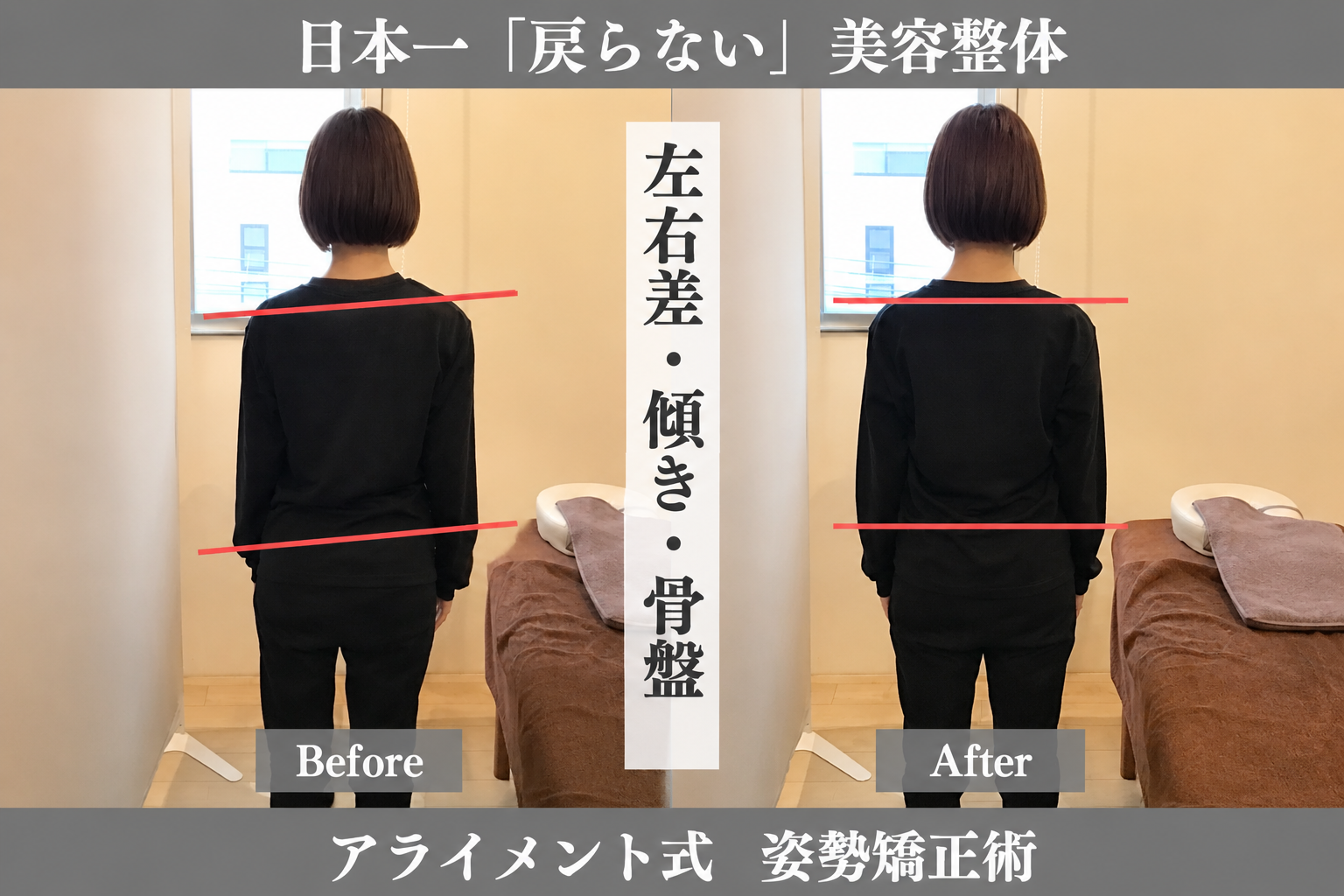 骨盤・肩甲骨の整体のBefore After — 背面・肩甲骨ライン｜Alignment TOKYO