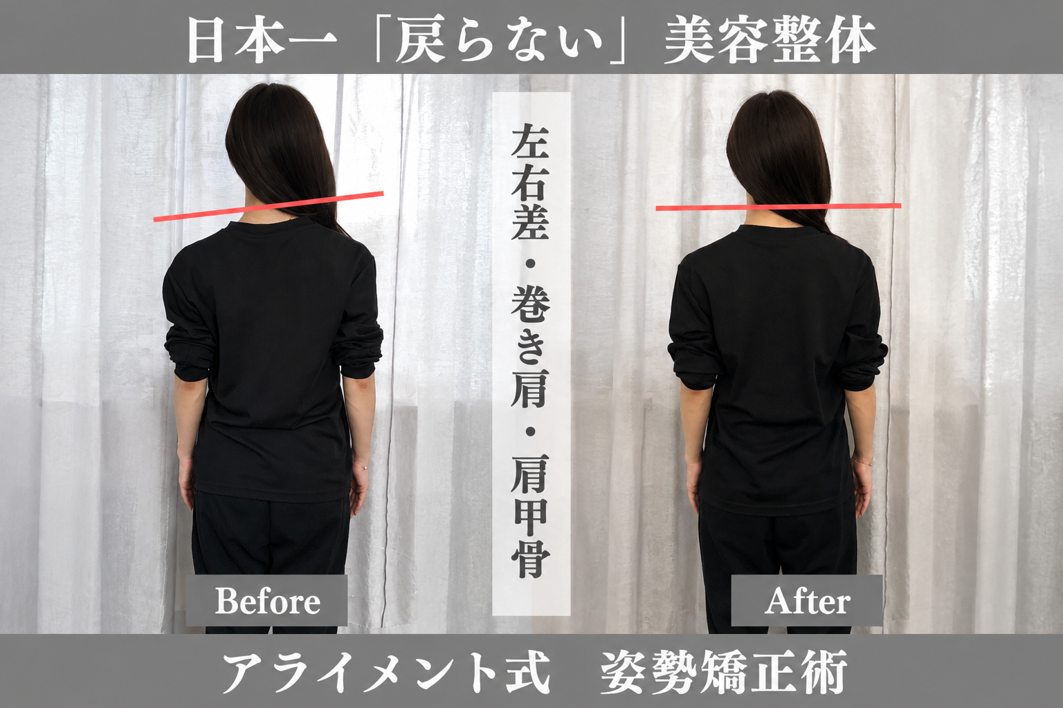 骨盤・肩甲骨の整体のBefore After — 背面・肩甲骨ライン｜Alignment TOKYO