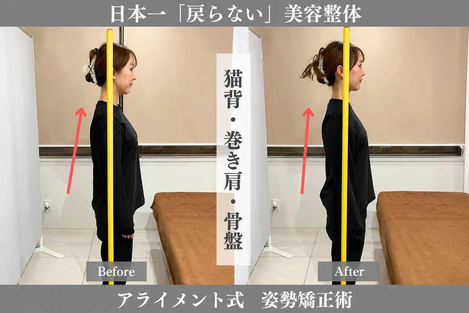 姿勢矯正のBefore After — 側面全身・姿勢｜Alignment TOKYO
