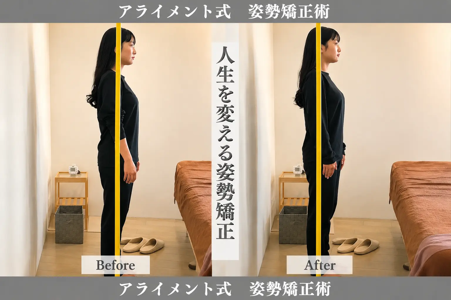 姿勢矯正のBefore After — 側面全身・姿勢｜Alignment TOKYO