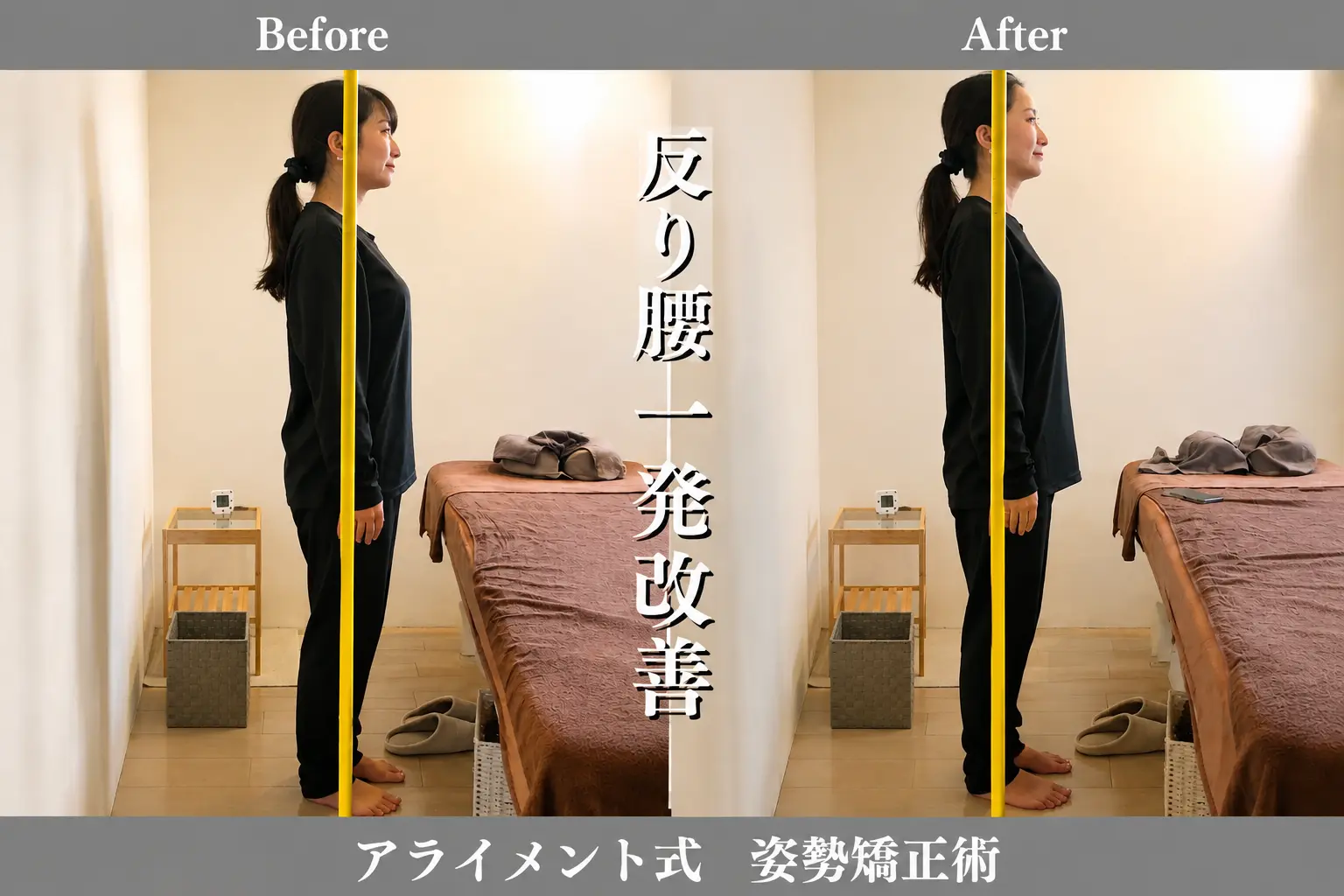 姿勢矯正のBefore After — 側面全身・姿勢｜Alignment TOKYO