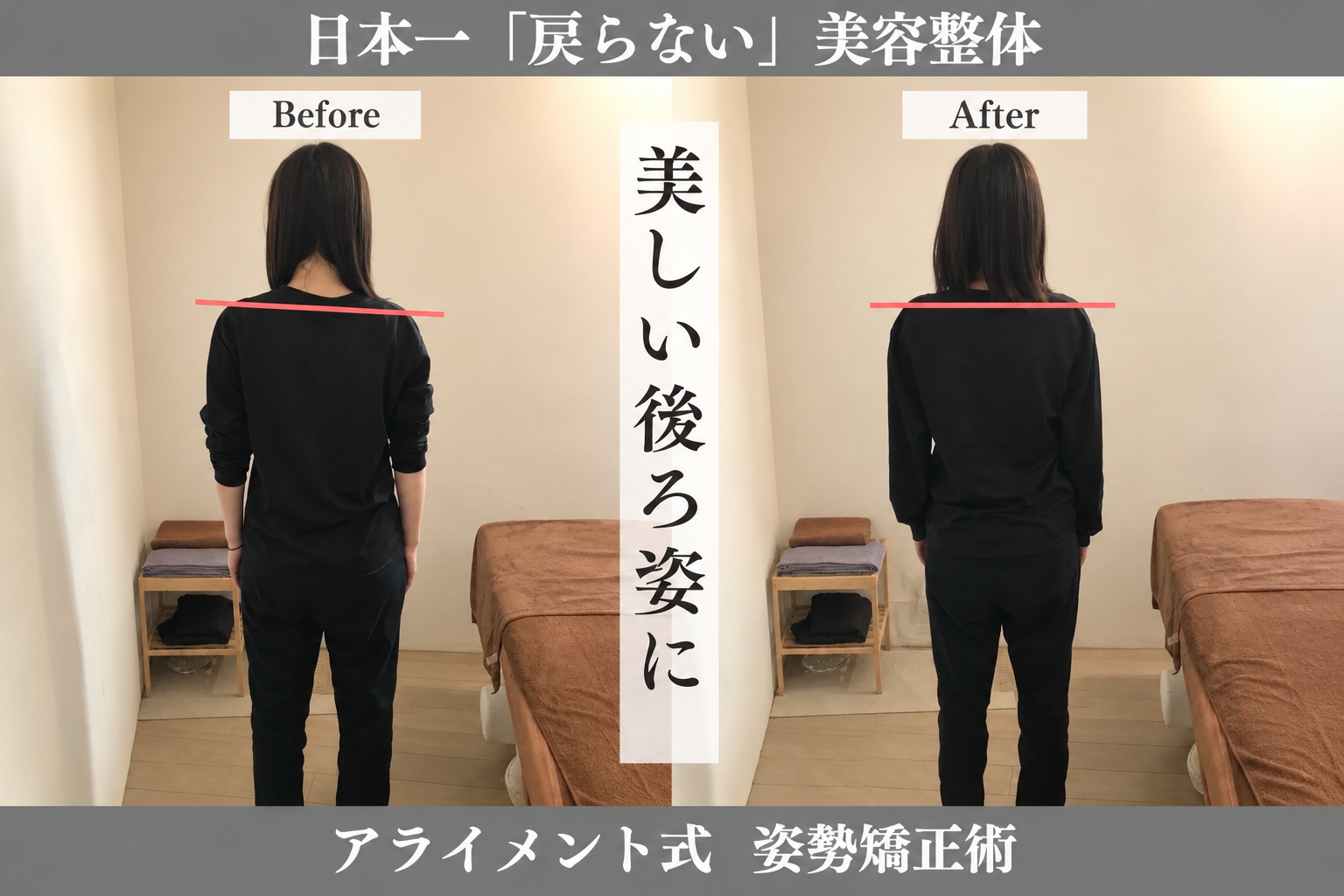 骨盤・肩甲骨の整体のBefore After — 背面・肩甲骨ライン｜Alignment TOKYO