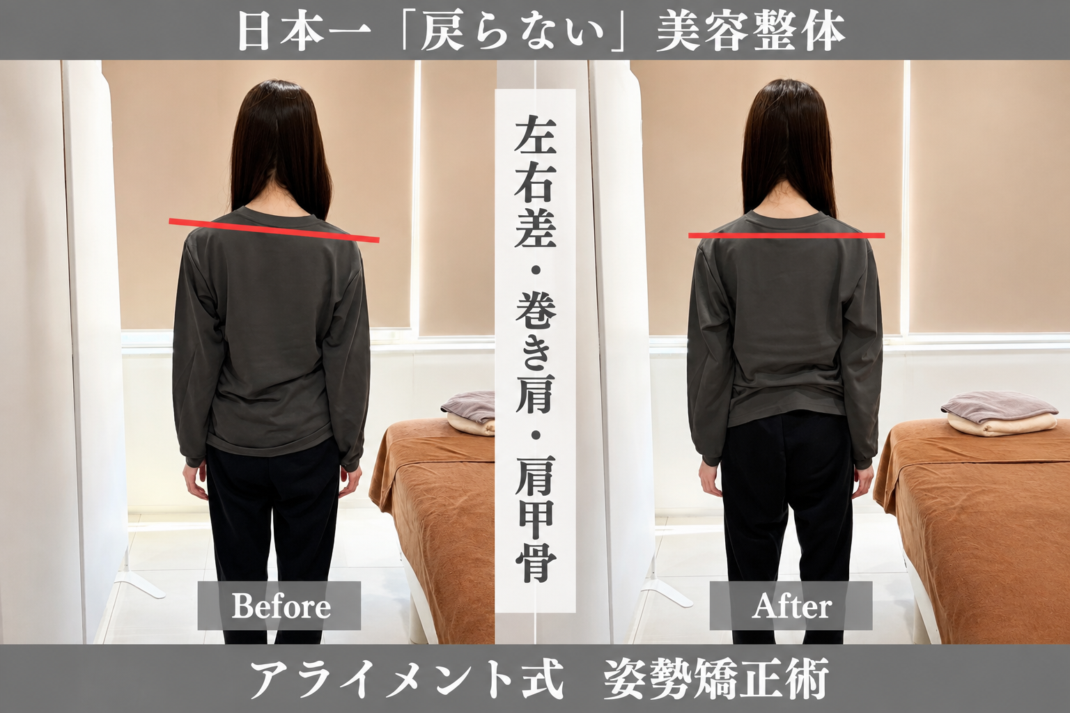 骨盤・肩甲骨の整体のBefore After — 背面・肩甲骨ライン｜Alignment TOKYO