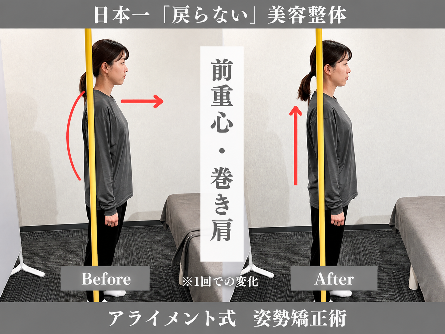 姿勢矯正のBefore After — 側面全身・姿勢｜Alignment TOKYO