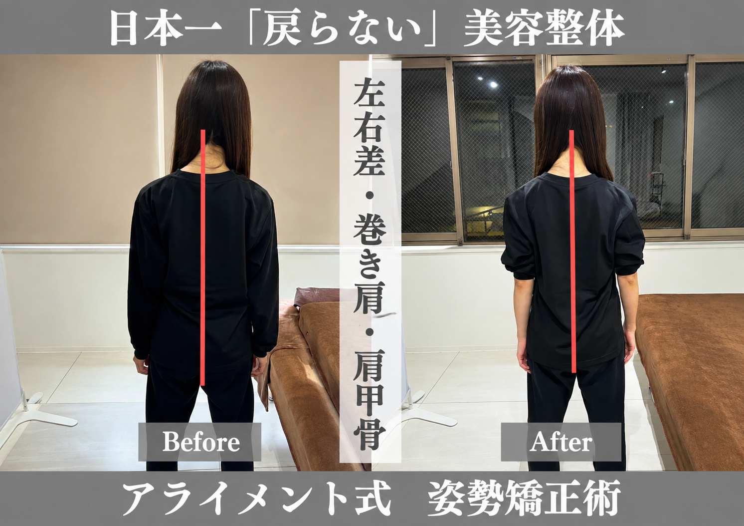 骨盤・肩甲骨の整体のBefore After — 背面・肩甲骨ライン｜Alignment TOKYO